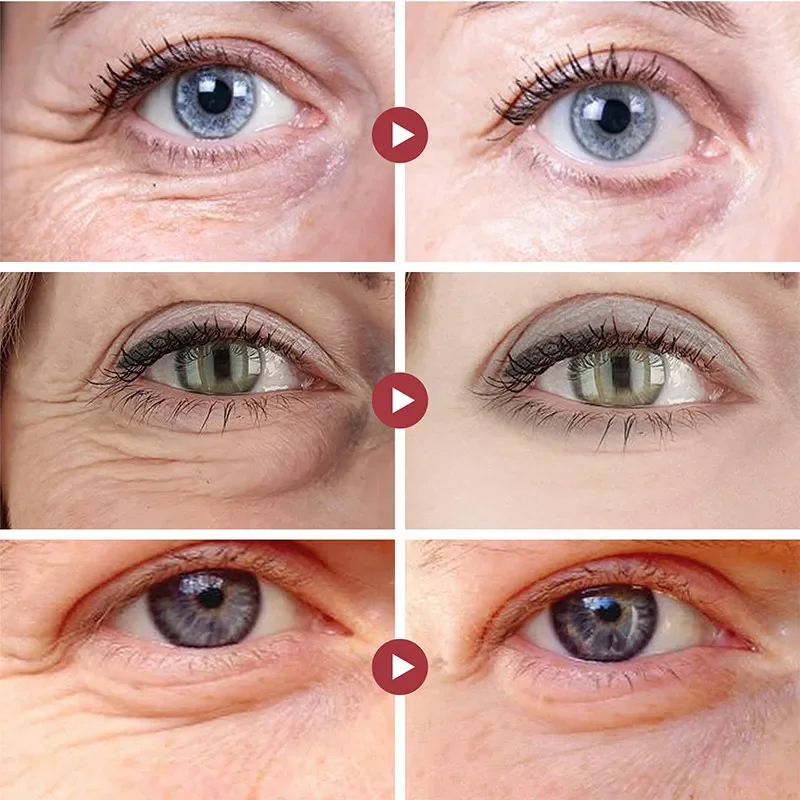 Falten Entfernen Augen Patches – Sheet Mask Collagen Bewertung und Preis
