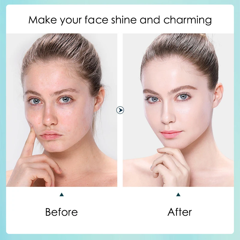 10 Stück Hyaluronsäure feuchti – Sheet Mask Collagen Bewertung und Preis